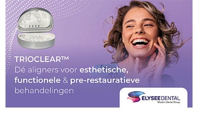 TrioClear™: Wetenschappelijk bewezen voor optimale tandverschuiving