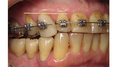 De interdisciplinaire benadering in de orthodontie 400