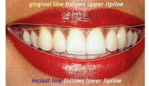 orthodontie 1