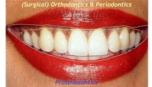 orthodontie 2