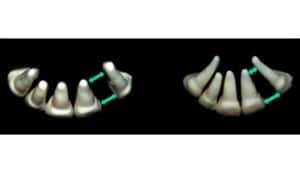 orthodontie