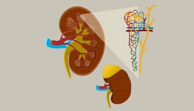 Causaal verband gevonden tussen chronische nierziekte en cariës