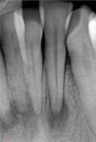 Botpathologie