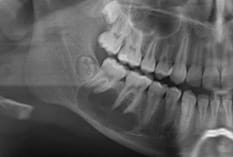 Botpathologie