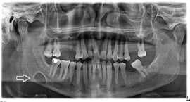 Botpathologie