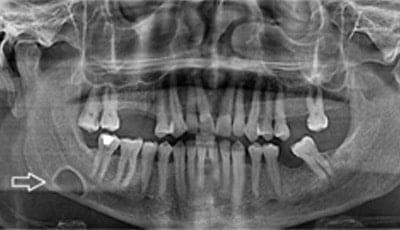 Botpathologie