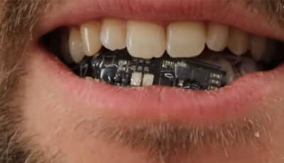 Onderzoekers TU Delft ontwikkelen geavanceerde slaapmonitoring met een multimodale mondsensor