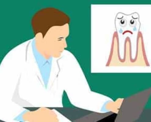 Vertalingen van de uitleg over diepe tandvleesontsteking Vertalingen van de uitleg over diepe tandvleesontsteking