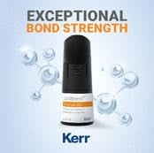 OptiBond Universal 360: De nieuwe generatie adhesie