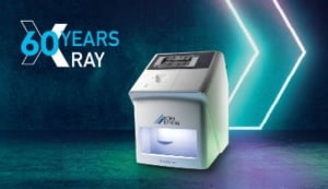 Durr - 60 jaar innovatie in röntgentechnologie
