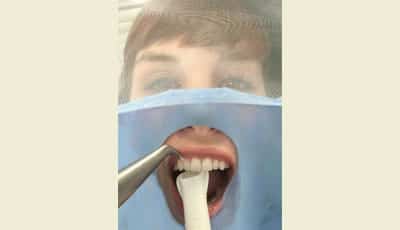 SafeDrape™: Meer comfort bij professionele profylaxe