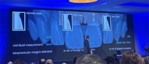 Tony Rotonde Soft tissue management & esthetiek bij anterieure restauraties