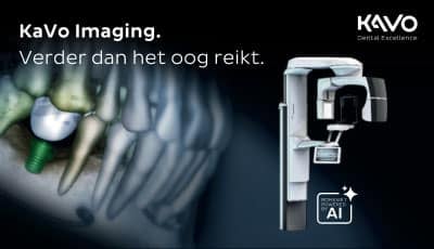 KaVo Imaging: Verder dan het oog reikt
