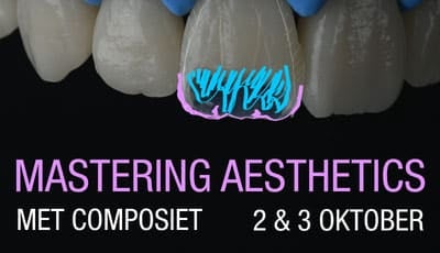 Mastering Aesthetics met composiet